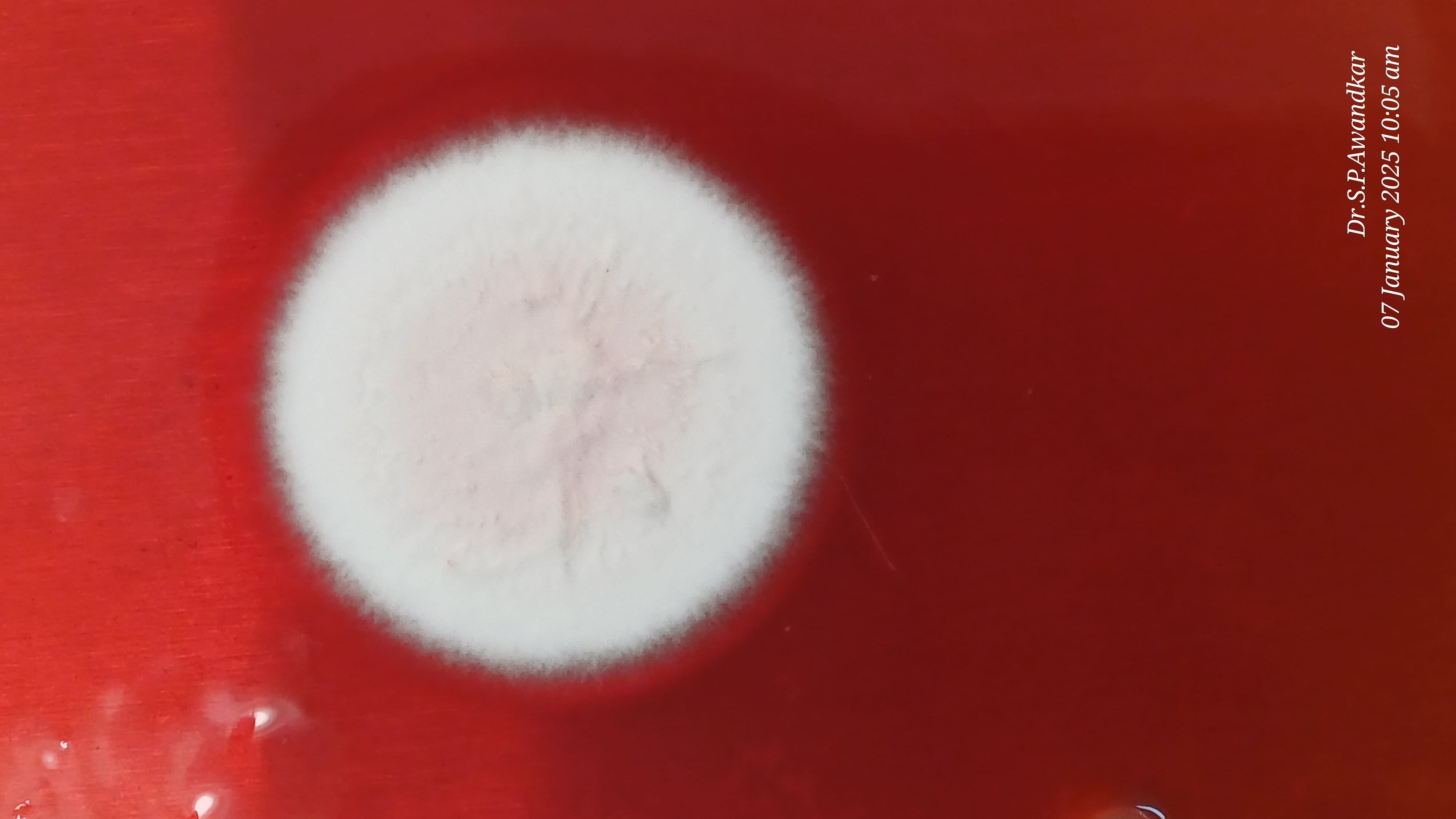 30. Trichophyton Mentagrophytes